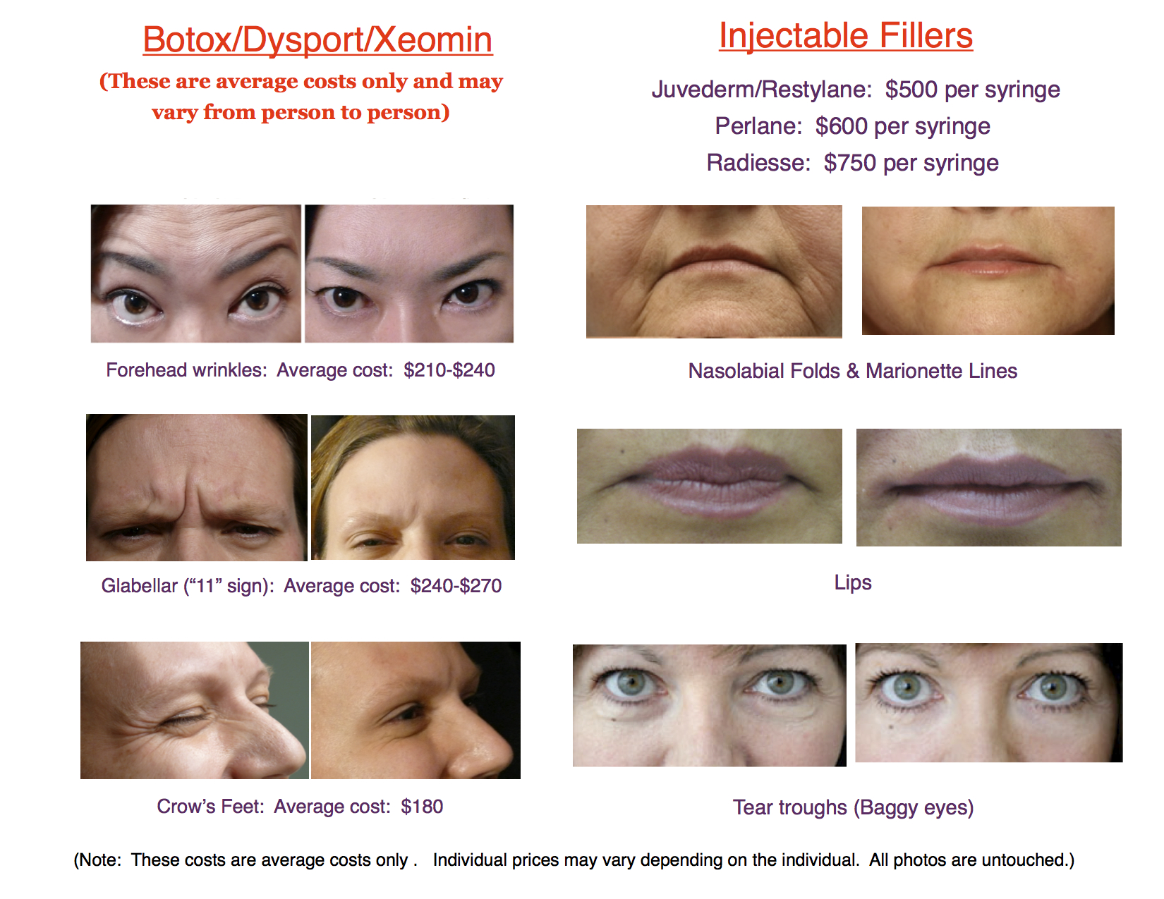 Prices for Botox, Dysport and Injectable Fillers in Honolulu