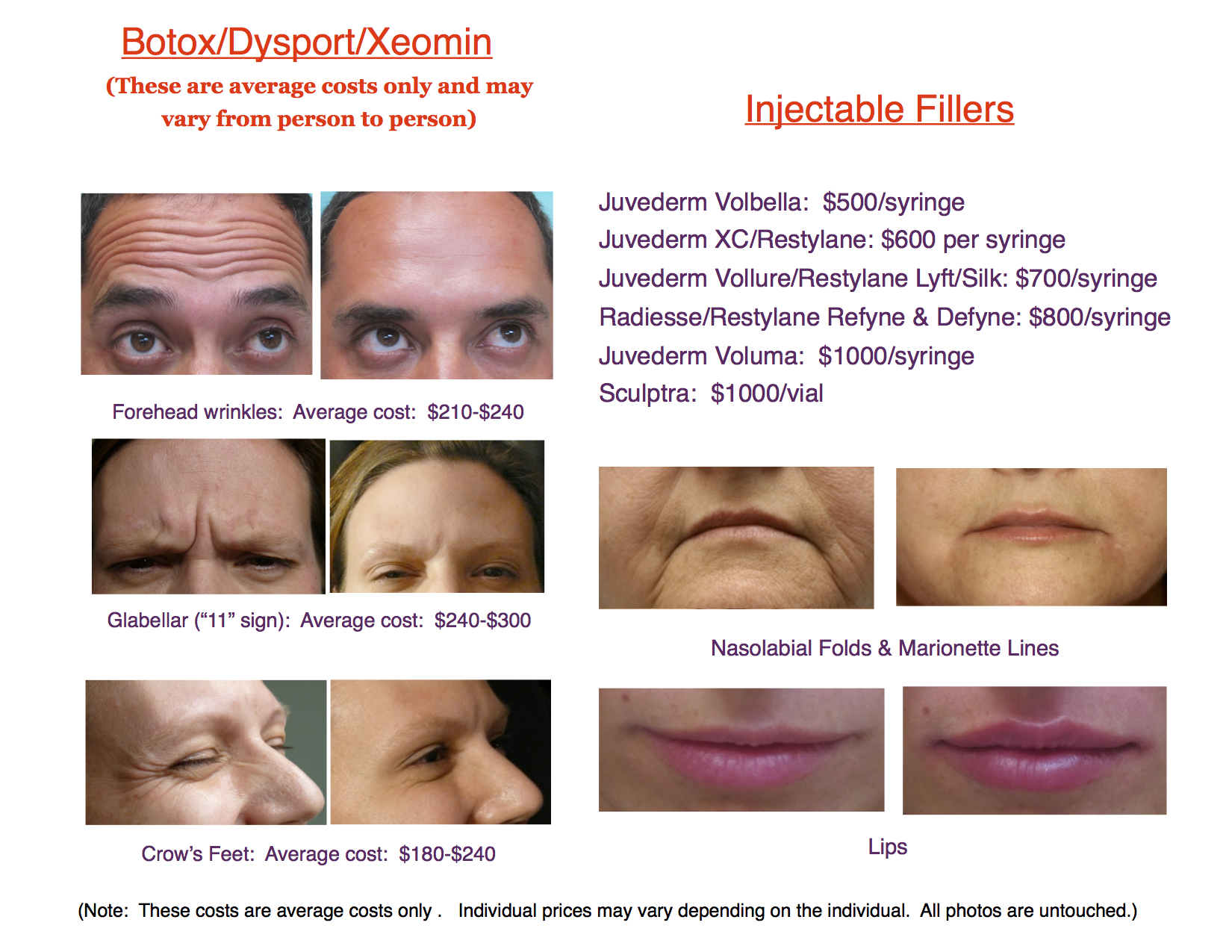 Prices for Botox, Dysport, Xeomin and Injectable Fillers in Honolulu